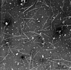 Electron micrograph of NMV