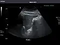 Liver