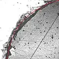 Bone radiography with edge detection displayed in overlay