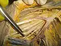 Dissection of human axilla
