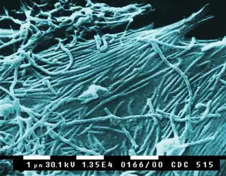 Ebola virus (Filoviridae)