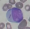 Blast cell