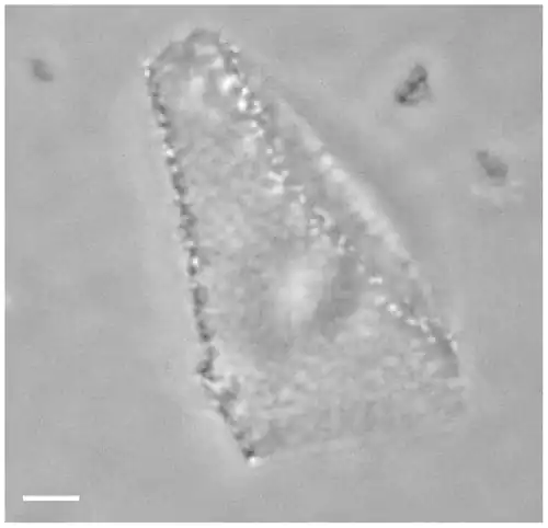 Optical phase-contrast microscopy image of a Haloquadratum walsbyi square cell. The numerous light dots are gas vesicles that allow flotation to the surface, most likely to acquire oxygen.[4] Scale bar 1 μm