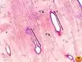 Bone by decalcification (100x): Volkmann's canal Haversian canal Lacuna Lamella