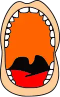 The mouth before surgery.