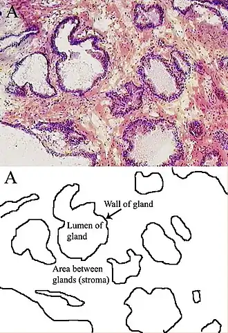 Microscopic glands of the prostate