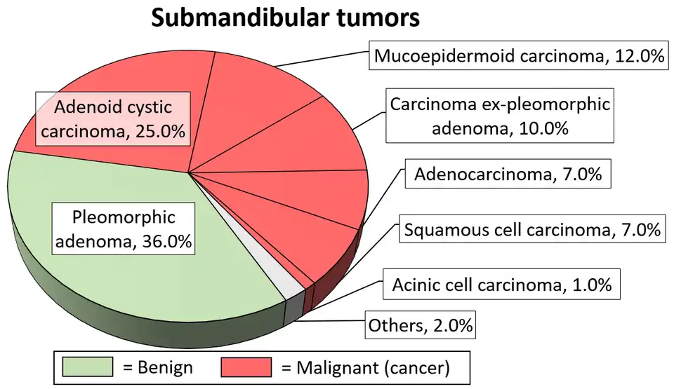 Relative incidence of submandibular tumors, showing mucoepidermoid carcinoma at top right.[15]