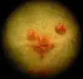 Rust fungus on a leaf, under low magnification